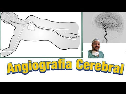 Avanços na Angiografia por Cateterismo Não Seletivo de Grande Vaso