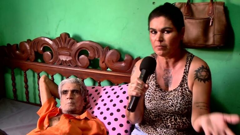 Edema na Virilha: Causas e Tratamentos