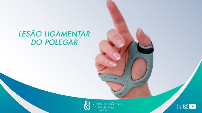 Entorse no dedo polegar da mão: causas, sintomas e tratamentos
