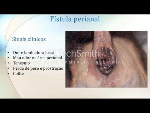 F&iacute;stula Perianal: Causas, Sintomas e Tratamento