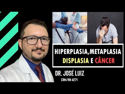 Entendendo o Pólipo Hiperplásico da Mucosa Gástrica