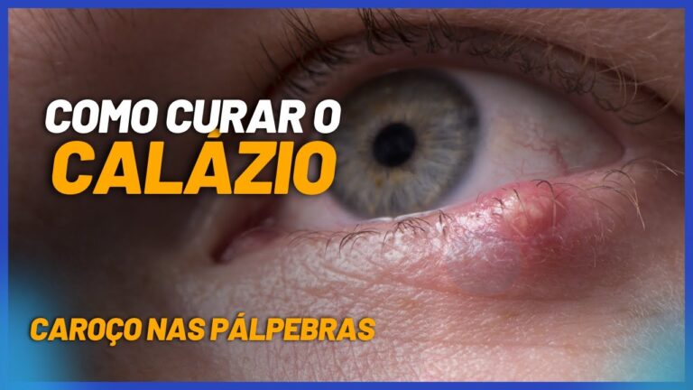 Bola de Gordura na Pálpebra: Causas e Tratamentos