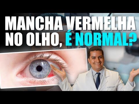 Como remover manchas na parte branca do olho