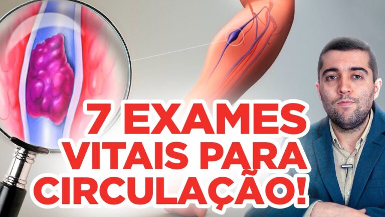Exames de sangue para detectar má circulação