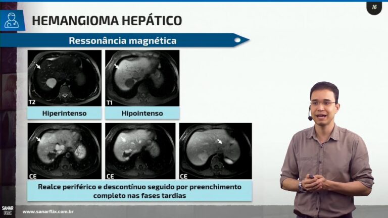 Nódulo Hiperecogênico Hepático: O Que Você Precisa Saber
