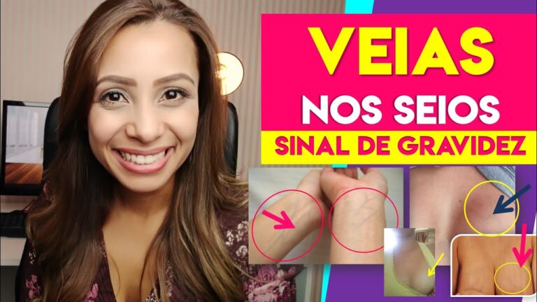 Veias Verdes na Mama: O que Significam?