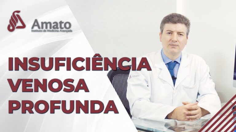 A Import&acirc;ncia do Sistema Venoso Profundo Competente