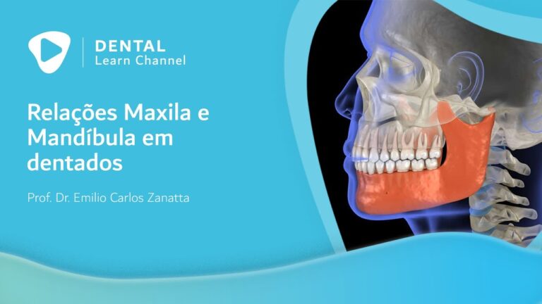 Entendendo a Mandíbula Grande: Causas e Tratamentos