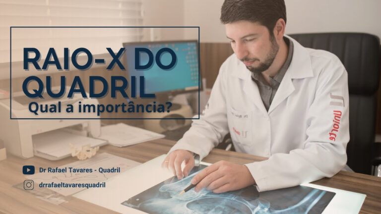 Diagn&oacute;stico de Desgaste no Quadril: A Import&acirc;ncia do Raio X