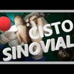 Cirurgia de Tendão na Mão: Tudo o Que Você Precisa Saber