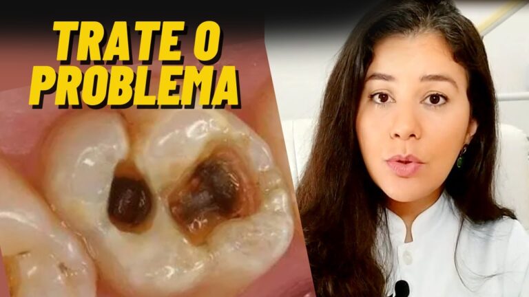 Dente Furado na Lateral: Causas e Tratamentos