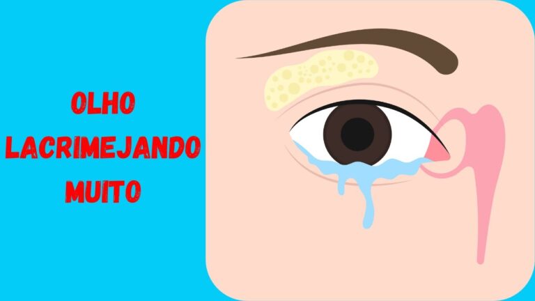 Olho lacrimejando constante: causas e tratamentos | Actualizado mayo 2026