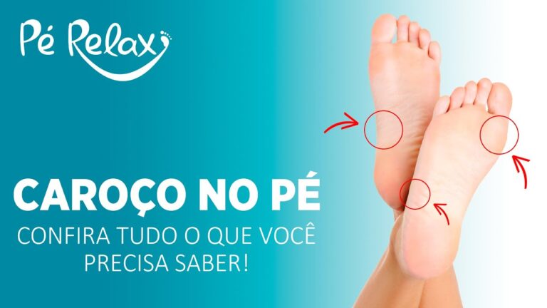Caroço no Pé: Causas e Tratamentos