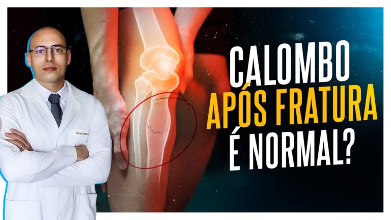 Calo Ósseo na Tibia: O Que Você Precisa Saber