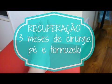 Tempo de cicatrização pós-cirurgia no pé