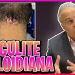 Cálculo de Insulina Regular por Peso: Guia Simplificado