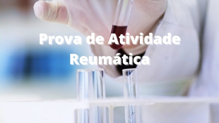 Avaliação da Atividade Reumática: Prova Eficiente e Conclusiva