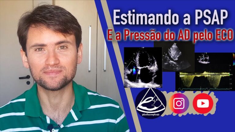 Pressão sistólica da artéria pulmonar: estimativa de 30 mmHg