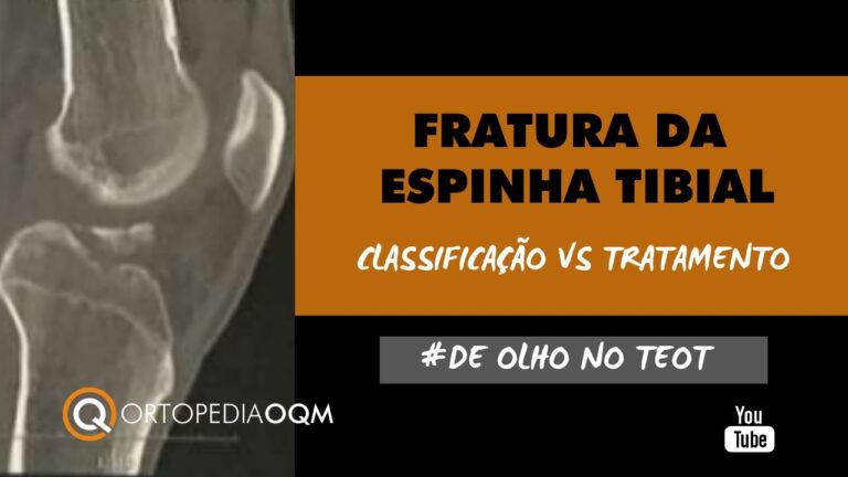 Como tratar eficazmente a espinha no joelho