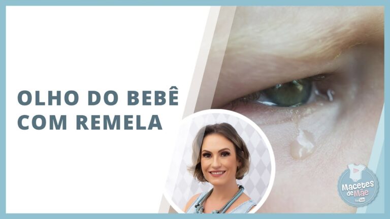 Remelinha em Recém-Nascido: O Que Significa e Como Lidar