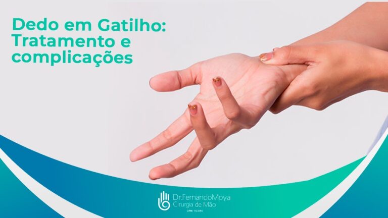 Tratamentos eficazes para dedo de gatilho