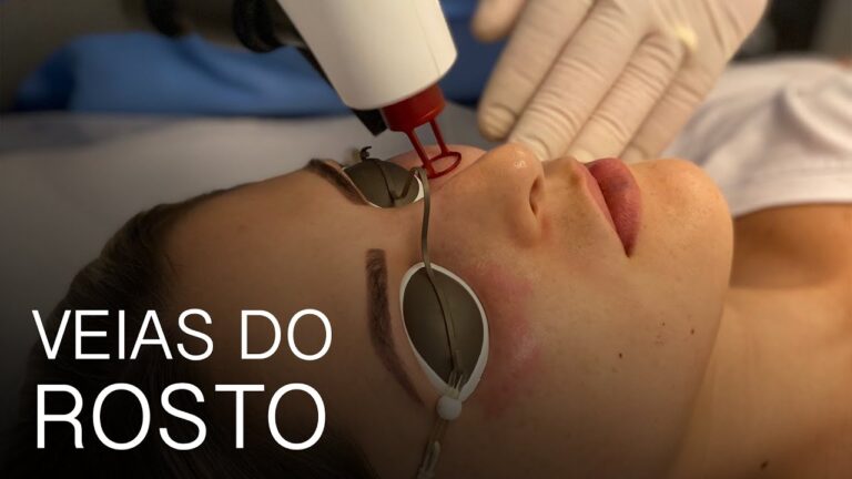 A verdade sobre a veia no meio da testa