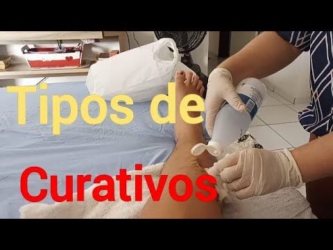 Guia completo dos tipos de curativos cirúrgicos