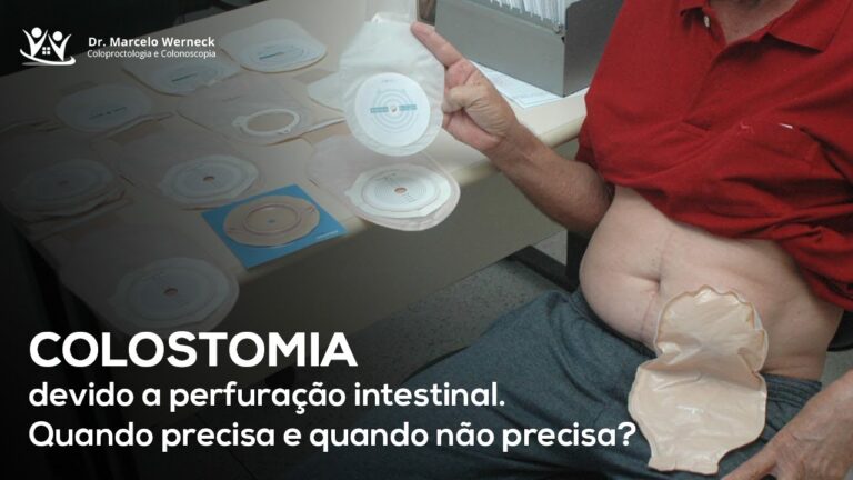 Recuperação do Intestino Perfurado: O Que Você Precisa Saber