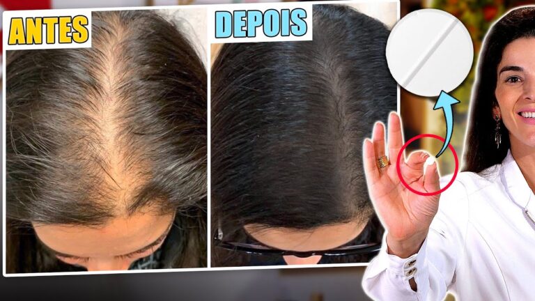 Como usar Paracetamol para cabelo saudável