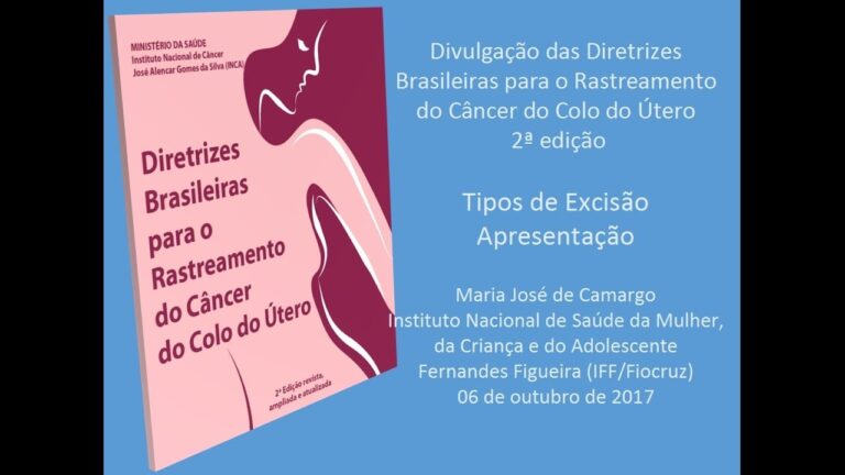 Tratamento na Zona de Transformação Tipo 3: Otimização
