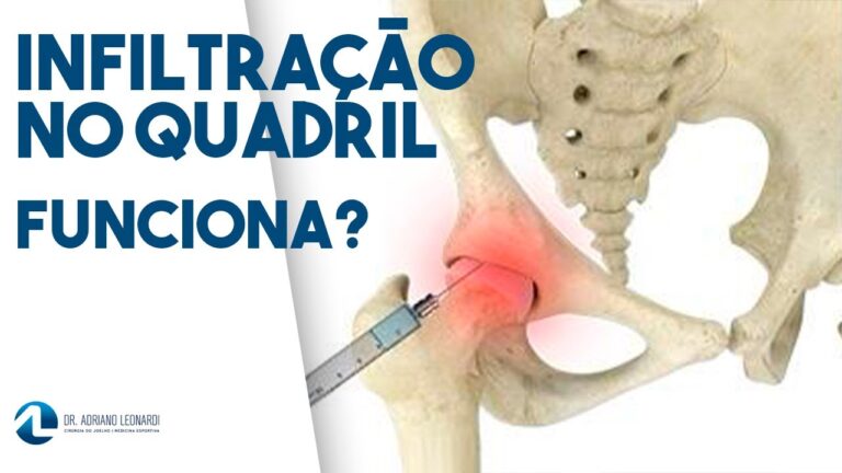 Tratamento eficaz para infiltração de bursite no quadril