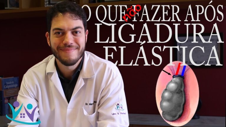 5 cuidados essenciais ap&oacute;s a ligadura el&aacute;stica de hemorroidas