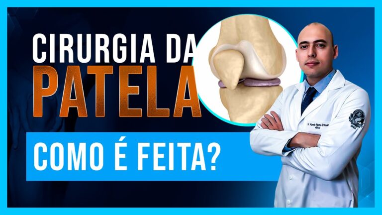 Cirurgia de patela com fios: Guia Completo