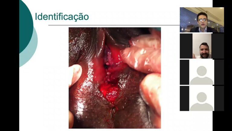 Laceração de Grau 1: Causas, Sintomas e Tratamento