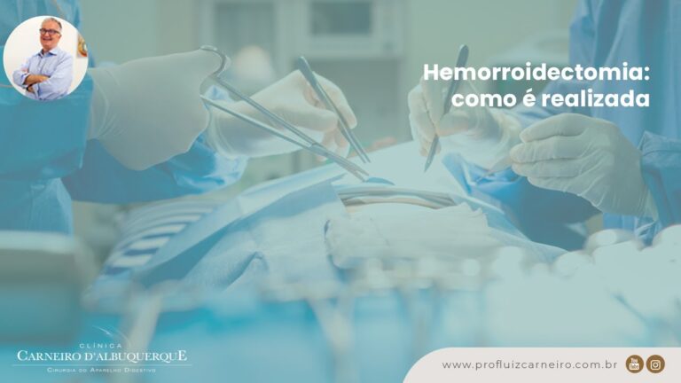 Hemorroidectomia: Tudo o que você precisa saber