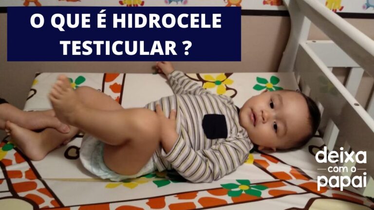 Hidrocele Testicular Infantil: Causas, Sintomas e Tratamento