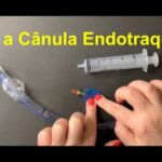 Dor cervical irradiando para o braço: causas e tratamentos