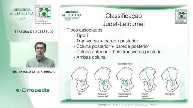 Complicações da fratura de acetábulo