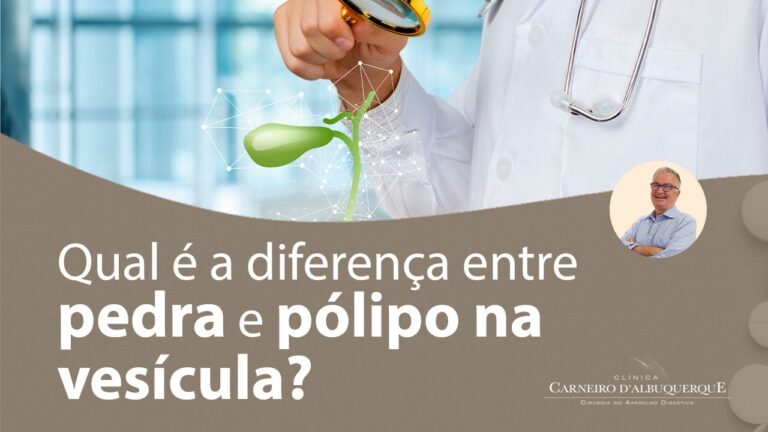 Principais causas de pólipo na vesícula