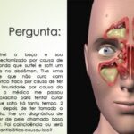Bolinha no ânus: causas e tratamentos