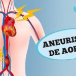 Calculadora de Escore de Lee: Otimize Seus Resultados