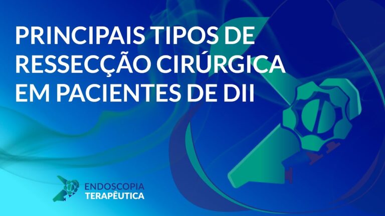 Ressec&ccedil;&atilde;o Cir&uacute;rgica: Guia Completo