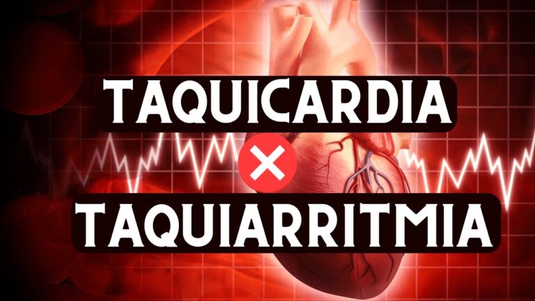 Taquicardia Atrial Não Sustentada: O Que Você Precisa Saber