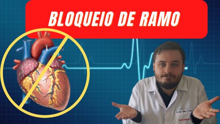 Entendendo o Bloqueio de Ramo: Causas, Sintomas e Tratamento