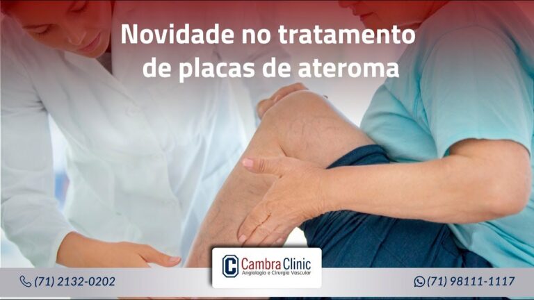Placas de Ateromatose: Causas, Sintomas e Tratamento