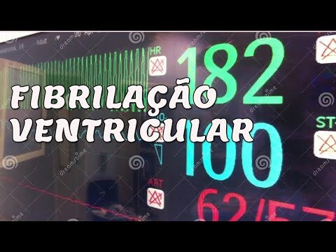 Medicamento eficaz para fibrilação ventricular