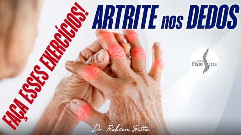 Tratamento eficaz para artrite nas mãos