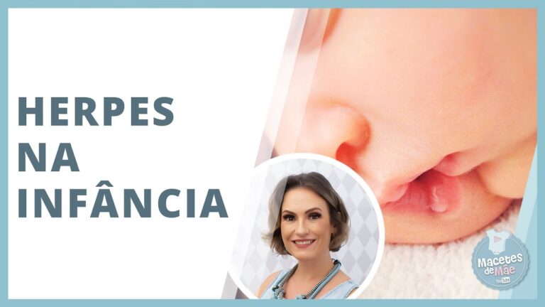 Uso de Aciclovir em Crianças: O Que Você Precisa Saber