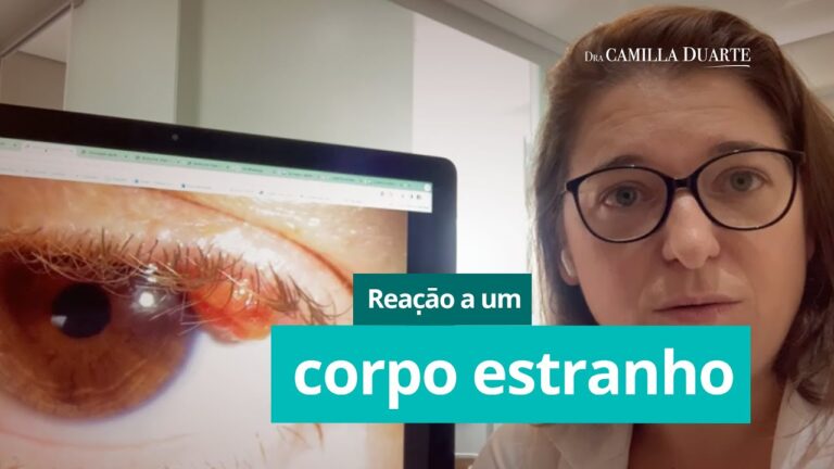 Granuloma no Olho: Causas, Sintomas e Tratamentos
