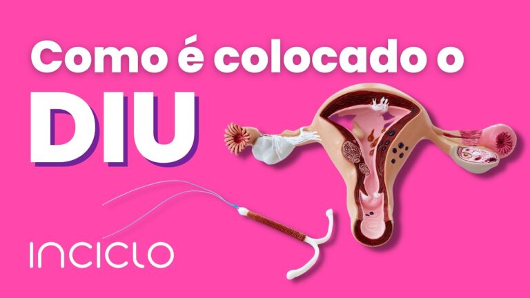 Posso Colocar DIU Durante a Menstruação? | Actualizado abril 2026